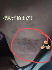 拍打腹股沟视频教程,视频教程详解